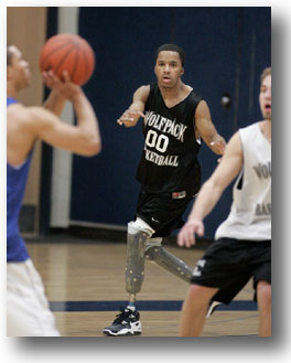 裝有假肢和手指的沃特金斯(Brandon Watkins)是他所在的威斯康辛州技術學院籃球隊的13名隊員之一