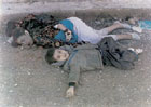 哈萊卜
傑化學武器攻擊的受害兒童